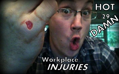 This little bugger took quite a long time to stop bleeding ... but, you know, I'm so bad ass for it.